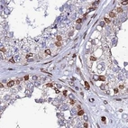 Immunohistochemical staining of human testis using Anti-TOR1AIP1 antibody HPA047151.