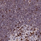 Immunohistochemical staining of human lymph node using Anti-TOR1AIP1 antibody HPA047151.