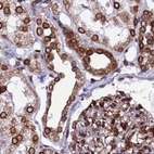 Immunohistochemical staining of human kidney using Anti-TOR1AIP1 antibody HPA047151.