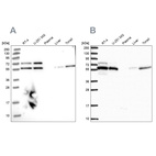 Anti-TOR1AIP1 Antibody