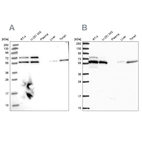 Western blot analysis using Anti-TOR1AIP1 antibody HPA047151 (A) shows similar pattern to independent antibody HPA050546 (B).