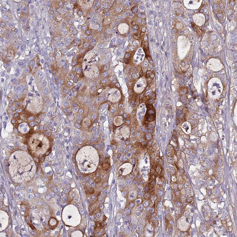 Anti-TNFRSF6B Antibody