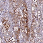 Anti-TNFRSF6B Antibody