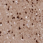 Immunohistochemical staining of human cerebral cortex shows strong cytoplasmic positivity in neurons.