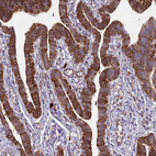 Immunohistochemical staining of human Fallopian tube shows strong cytoplasmic positivity in glandular cells.