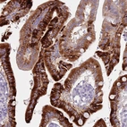 Immunohistochemical staining of human duodenum shows strong cytoplasmic positivity in glandular cells.