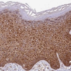 Immunohistochemical staining of human skin shows moderate cytoplasmic positivity in squamous epithelial cells.