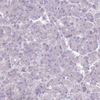 Anti-TNFRSF6B Antibody