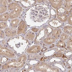 Anti-MRPS17 Antibody