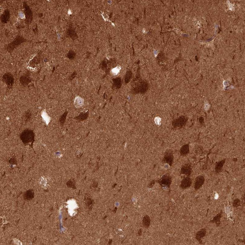 Anti-PPP3R1 Antibody