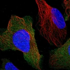 Immunofluorescent staining of human cell line U-2 OS shows localization to plasma membrane.