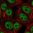 Immunofluorescent staining of human cell line MCF7 shows localization to nucleoplasm.