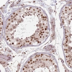 Immunohistochemical staining of human testis shows strong nuclear/nuclear membranous positivity in cells in seminiferous ducts with weak cytoplasmic positivity.