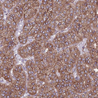 Anti-EI24 Antibody