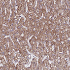 Anti-EI24 Antibody