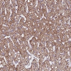 Immunohistochemical staining of human liver shows strong cytoplasmic granular positivity in hepatocytes.