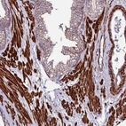 Immunohistochemical staining of human prostate shows strong cytoplasmic granular positivity in smooth muscle cells.