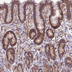 Anti-EI24 Antibody