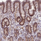 Immunohistochemical staining of human stomach shows strong cytoplasmic granular positivity in glandular cells.