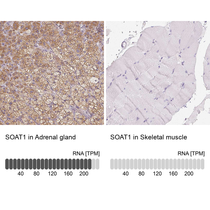 Anti-SOAT1 Antibody
