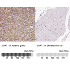 Anti-SOAT1 Antibody