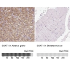 Anti-SOAT1 Antibody