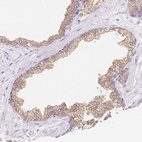 Immunohistochemical staining of human prostate shows moderate granular cytoplasmic positivity in glandular cells.