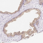 Immunohistochemical staining of human prostate shows moderate granular cytoplasmic positivity in glandular cells.