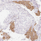 Immunohistochemical staining of human testis shows moderate granular cytoplasmic positivity in Leydig cells.