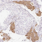 Immunohistochemical staining of human testis shows moderate granular cytoplasmic positivity in Leydig cells.