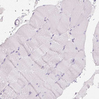 Immunohistochemical staining of human skeletal muscle shows no positivity in myocytes as expected.
