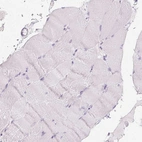 Immunohistochemical staining of human skeletal muscle shows no positivity in myocytes as expected.
