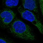 Immunofluorescent staining of human cell line A-431 shows localization to endoplasmic reticulum.