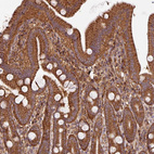 Immunohistochemical staining of human duodenum shows strong cytoplasmic positivity in glandular cells.