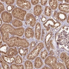 Immunohistochemical staining of human kidney shows strong cytoplasmic positivity in cells in tubules.