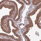 Immunohistochemical staining of human fallopian tube shows strong cytoplasmic positivity in glandular cells.