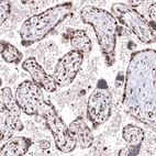 Immunohistochemical staining of human placenta shows moderate to strong nuclear positivity in trophoblastic cells.
