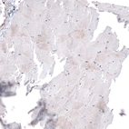 Immunohistochemical staining of human skeletal muscle shows negative to very weak positivity in a subset of myocytes.