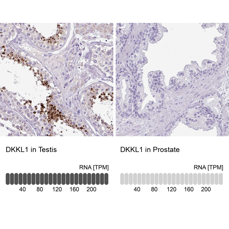 Anti-DKKL1 Antibody