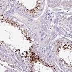 Immunohistochemical staining of human testis shows high expression.
