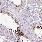 Immunohistochemical staining of human testis shows high expression.