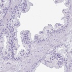 Immunohistochemical staining of human prostate shows low expression as expected.