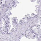 Immunohistochemical staining of human prostate shows low expression as expected.