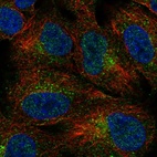 Immunofluorescent staining of human cell line A549 shows localization to vesicles.