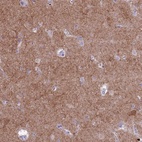 Anti-PDE10A Antibody