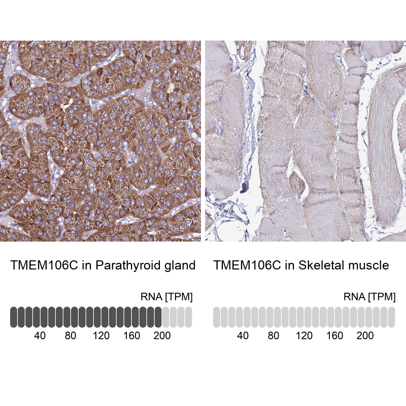 Anti-TMEM106C Antibody