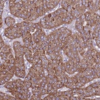 Anti-TMEM106C Antibody