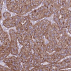 Immunohistochemical staining of human parathyroid gland shows high expression.