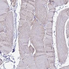 Immunohistochemical staining of human skeletal muscle shows low expression as expected.