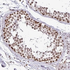 Immunohistochemical staining of human testis shows moderate to strong nuclear positivity in cells in seminiferous ducts.